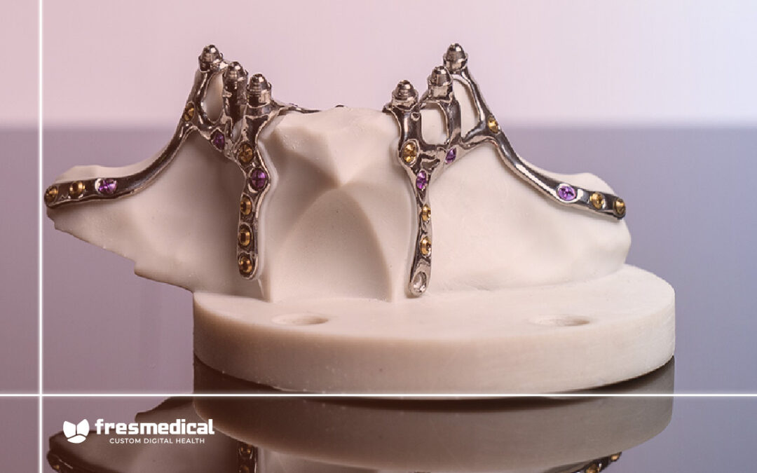 Cómo diseñamos y fabricamos los implantes subperiósticos