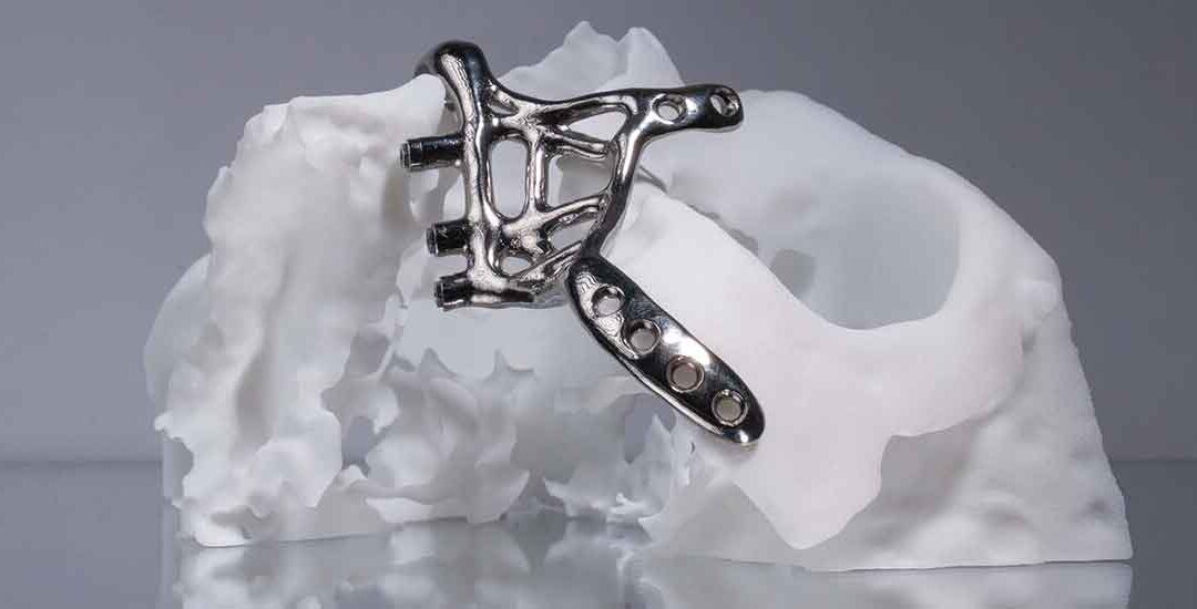 Protegido: Implantes subperiósticos hoy: planificación, diseño y fabricación con criterio