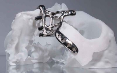 Protegido: Implantes subperiósticos hoy: planificación, diseño y fabricación con criterio