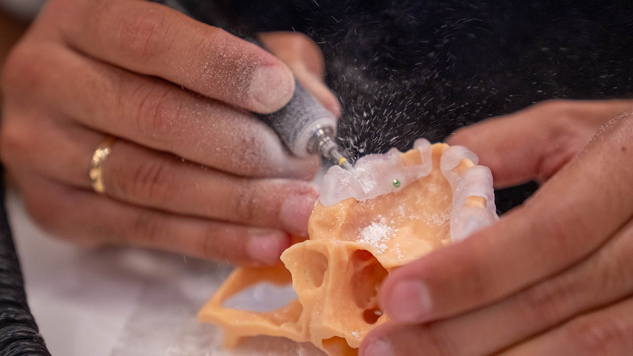 implantes subperiósticos de Fresmedical.